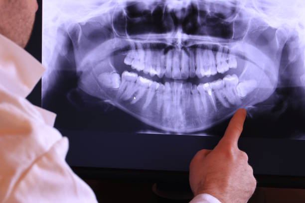Best Emergency TMJ Treatment in Gladeville, TN
