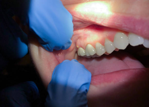 Best Weekend Emergency Dentist in Gladeville, TN