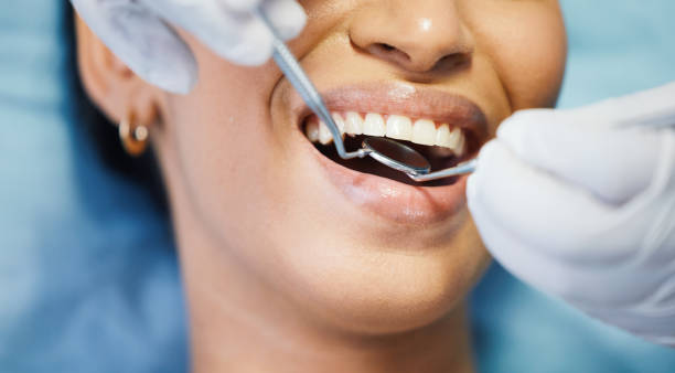 Best Emergency Dental Care for Broken or Chipped Teeth in Gladeville, TN